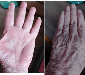 Hand 3