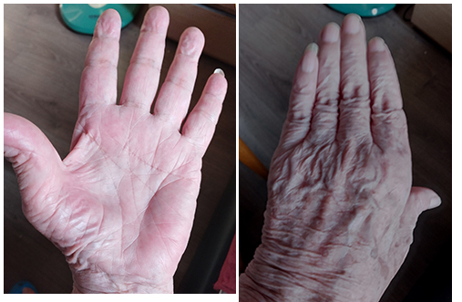 Hand 3